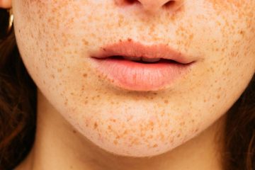 How Do You Know If You Have Skin Cancer on Your Lip